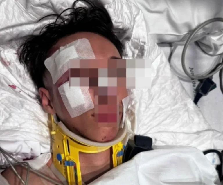 Familie zoekt getuigen na aanrijding in Málaga: 19-jarige zwaargewond, automobilist rijdt door